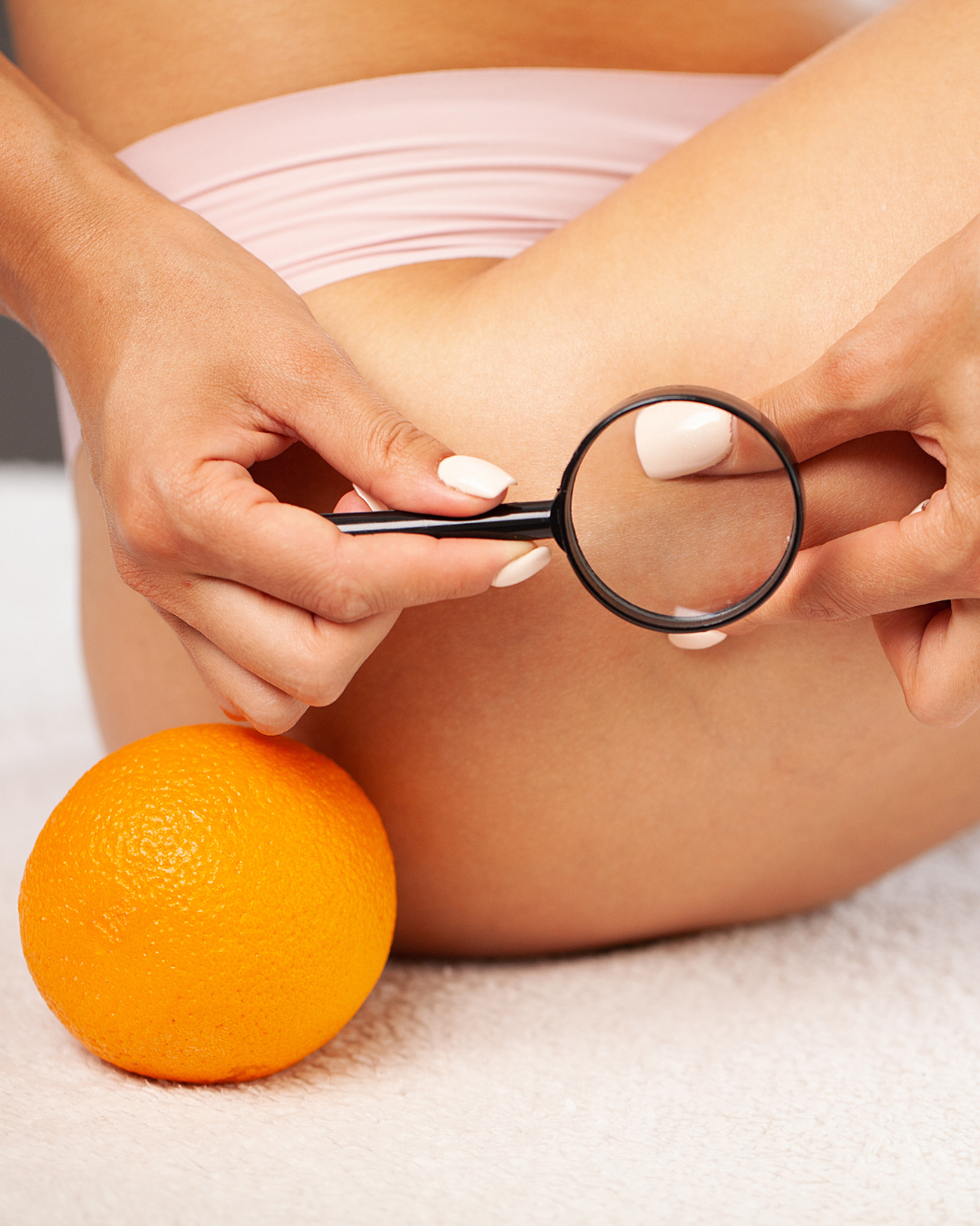 Ritenzione idrica o cellulite? Facciamo chiarezza!